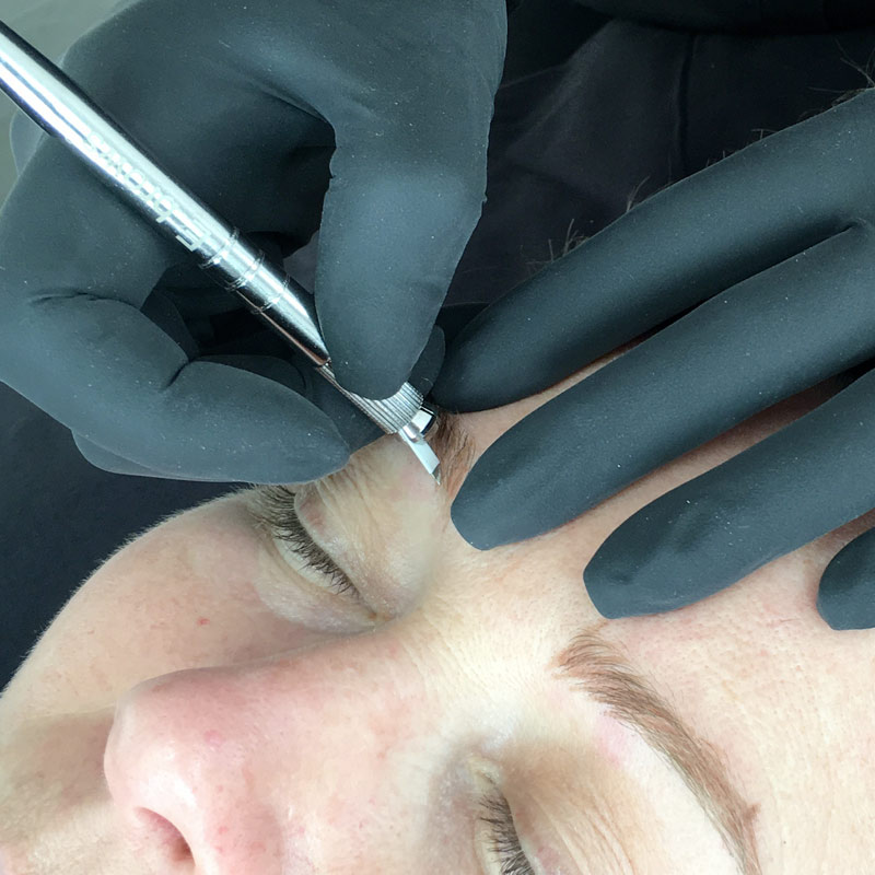 Formation microblading